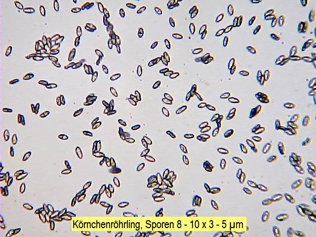 Sporen Körnchenröhrling